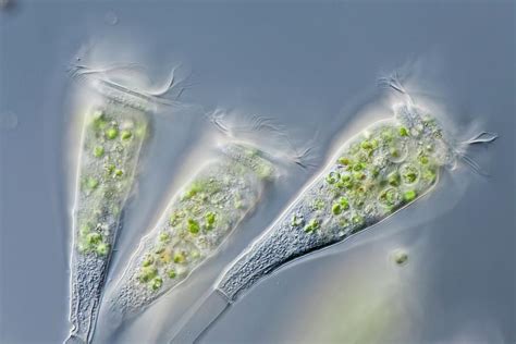  Epistylis: Un Mystère Cilié en Forme de Fleur Délicate qui Danse sous l'Eau !